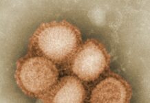 장 건강과 면역력 강화, 건강한 생활습관의 중요성 a picture of a bunch of balls on a table